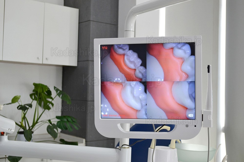 歯科用口腔内カメラ 17インチ液晶モニター付き